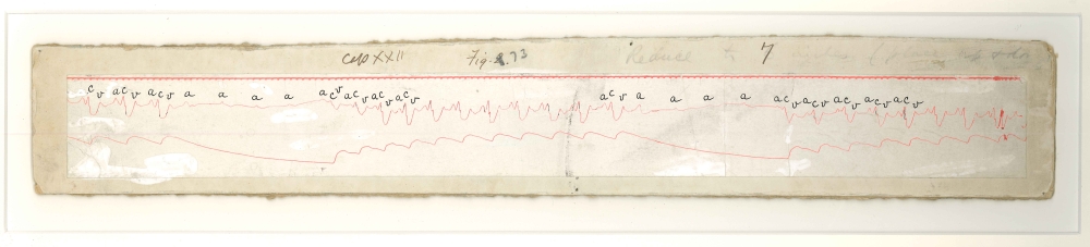Heart Block, Ink Polygraph, Thomas Lewis