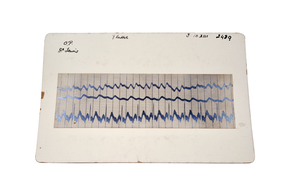 Original ECG Recording (MR.101.3)