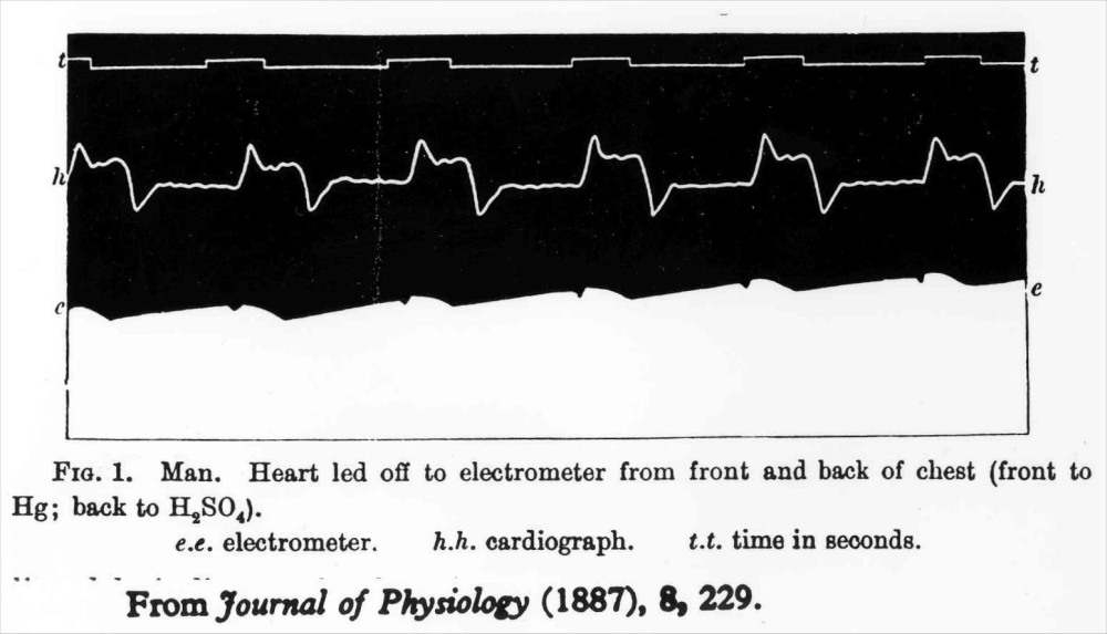 Original Recording, Journal of Physiology